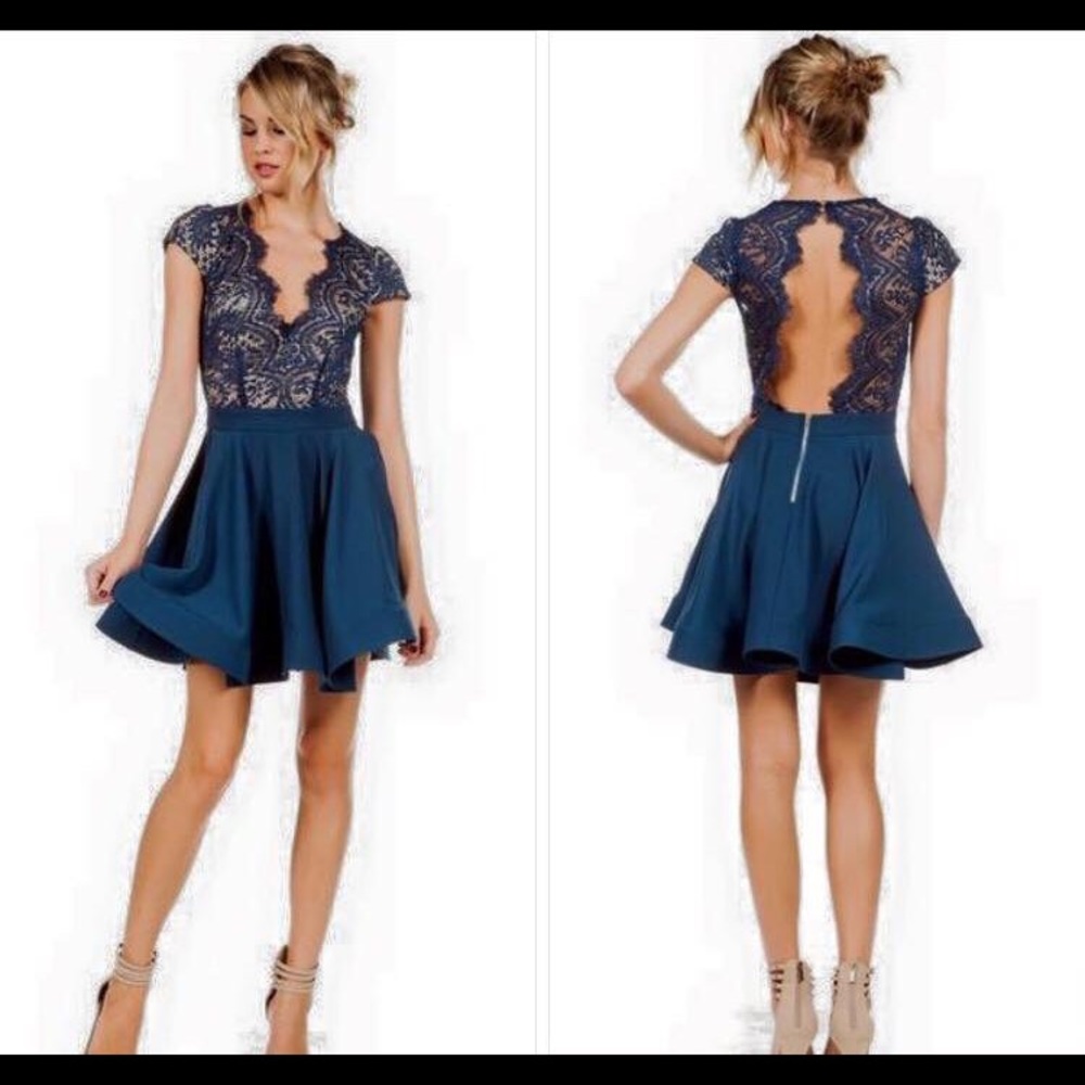 Teal Lace Flare Dress